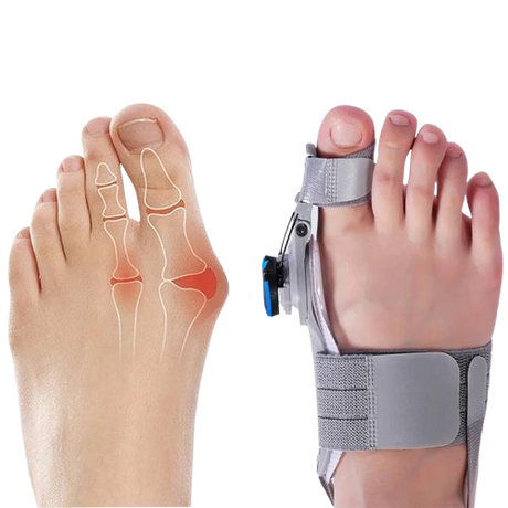Natural Bunions Corrector Toe Spacer